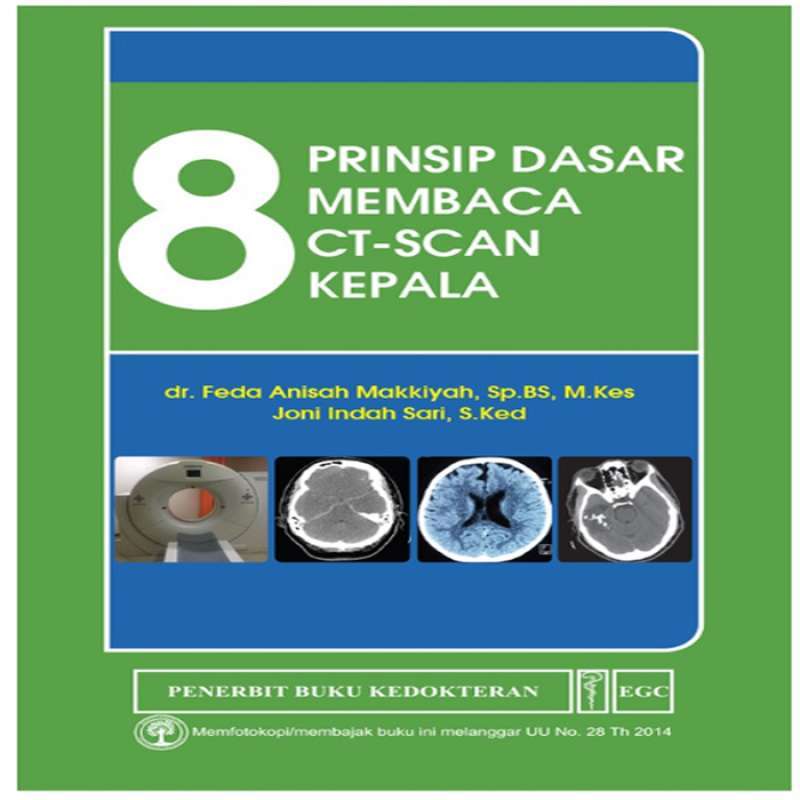 Jual 8 Prinsip Dasar Membaca Ct Scan Kepala Egc Original Online Maret 2021 Blibli