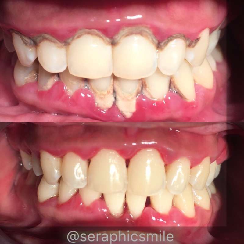 Jual Seraphic Smile Dental Spa Cuci Gigi Pembersihan Karang Gigi Di Seller Seraphic Smile Kota Jakarta Selatan Dki Jakarta Blibli