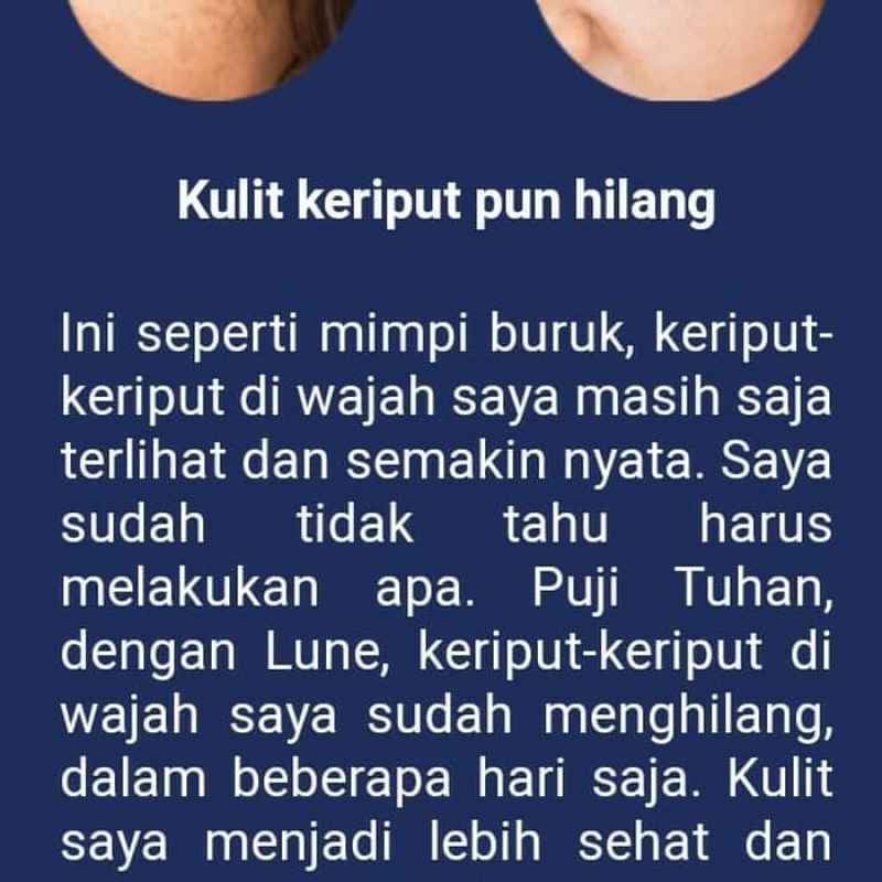 Jual Lune Serum Original 100 Asli Serum Menghilangkan Kerutan Wajah Anti Aging Online Oktober 2020 Blibli Com