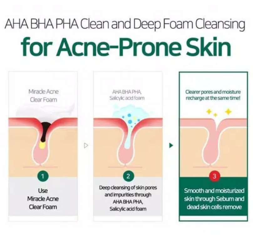 Jual Some By Mi Aha Bha Pha 30 Days Miracle Acne Clear Form Online September 2020 Blibli Com