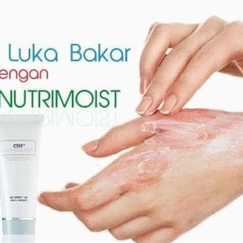 Jual Cni Nutrimoist Cream Luka Bakar Selulit Stretch Mark 20 Gr Online November 2020 Blibli Com