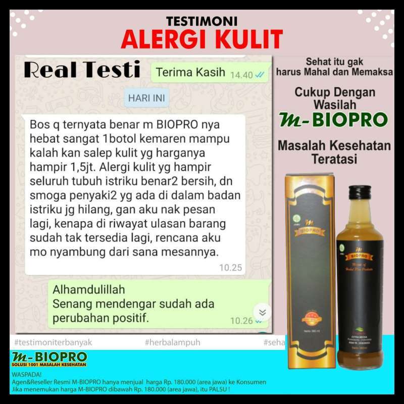 Jual Best Seller M Biopro Asli Obat Herbal Alergi Gatal Gatal Kulit Eksim Isi 380ml Mbiopro Terbukti Ampuh Wasilah Mengatasi Segala Penyakit Online November 2020 Blibli Com