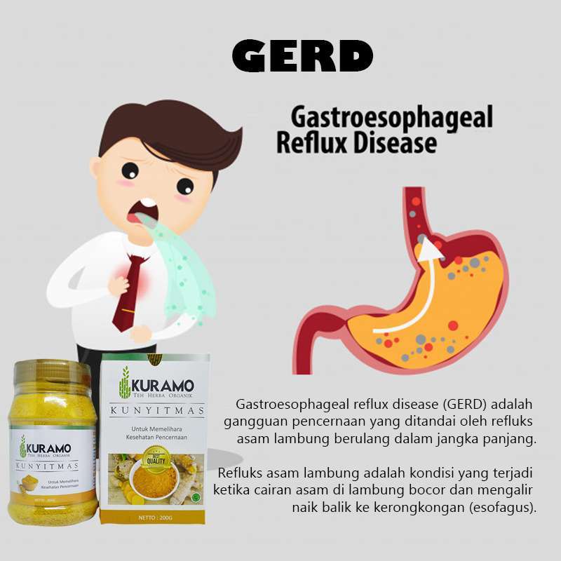Jual Kuramo Kunyit Mas Jamu Herbal Original 200 Gr Murah Mei 2021 Blibli