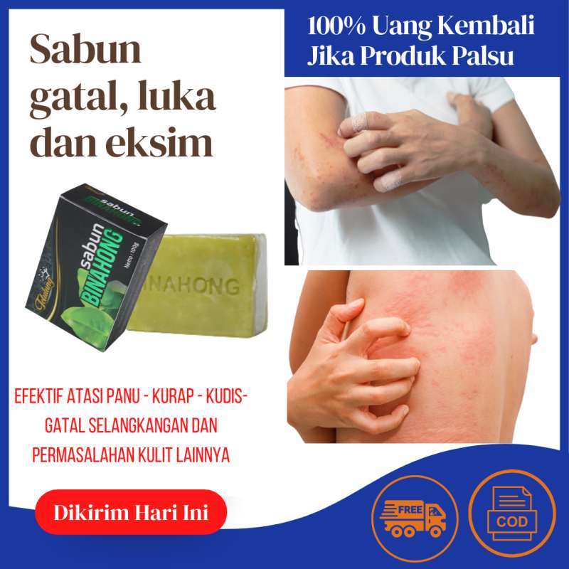 Obat gatal kulit paling ampuh