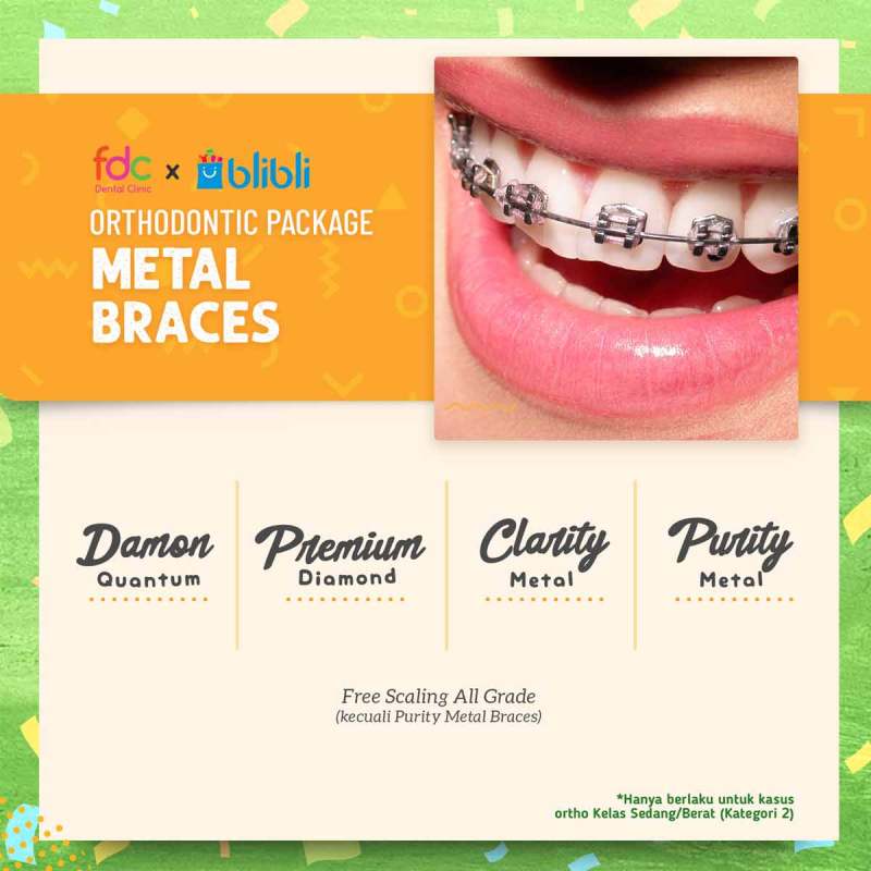 Jual Fdc Dental Clinic Behel Metal Premium Diamond Perawatan Gigi Online September 2020 Blibli Com