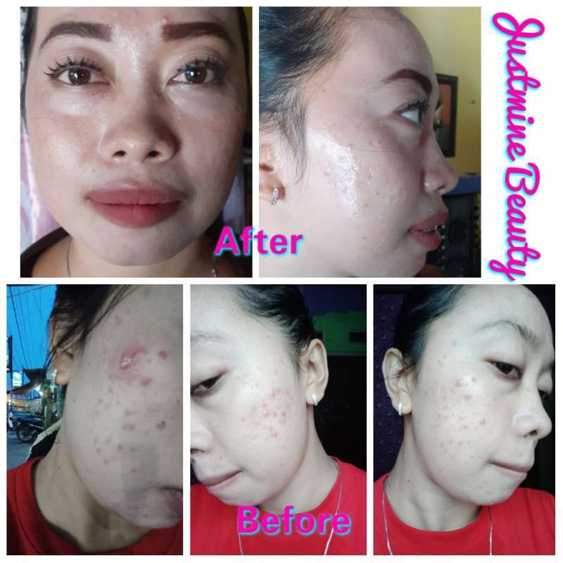 justmine skincare