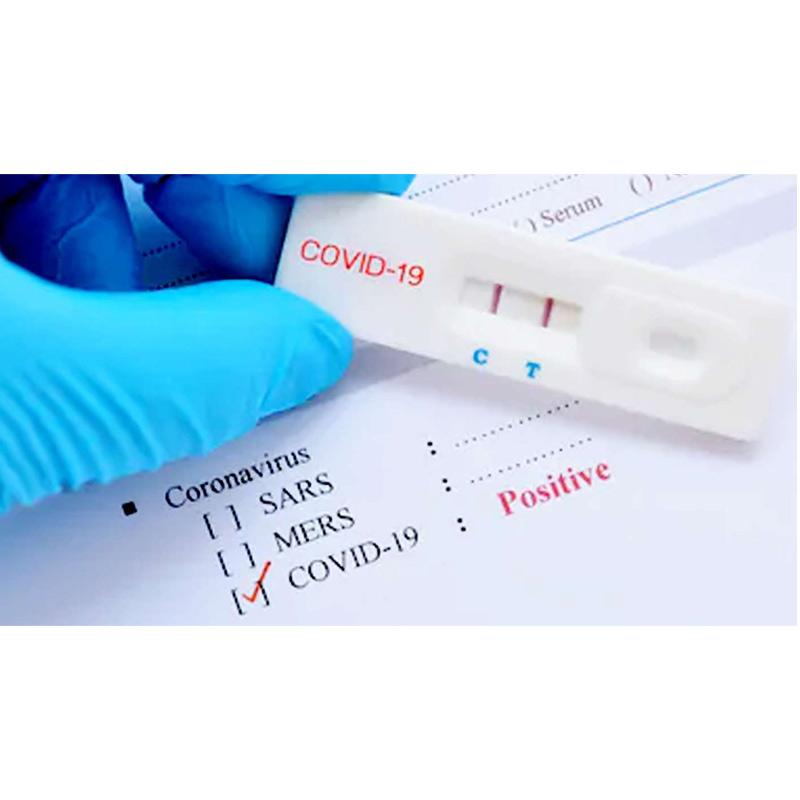 Jual Rapid Test Perorangan By Klinik Permata Indah Medical Center Online Desember 2020 Blibli