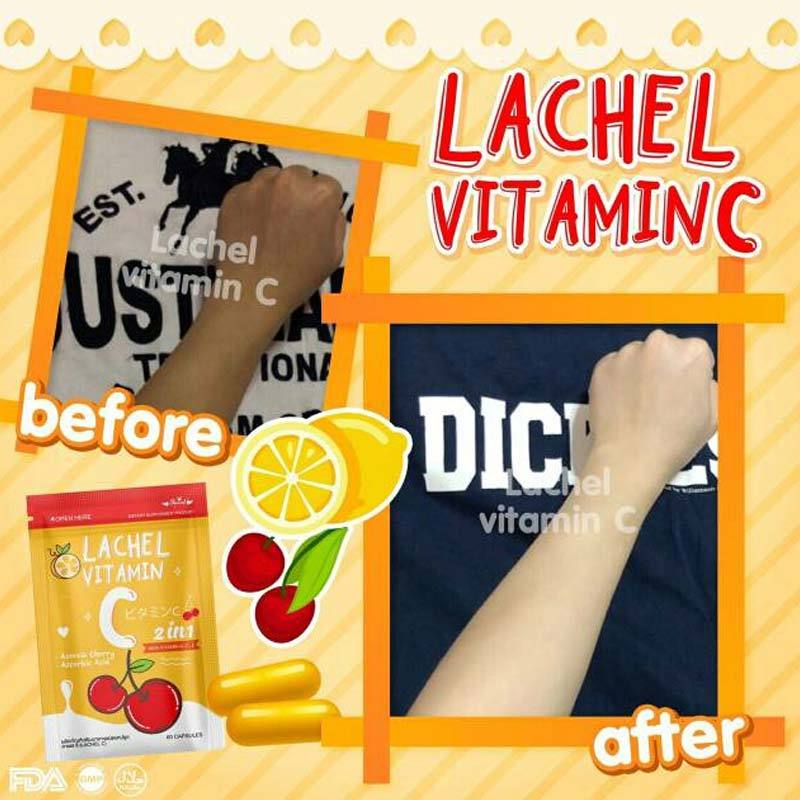 Download Laechel Free HD