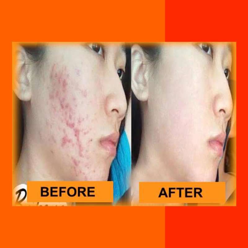 100 Original Sabun Wajah Espio Kolagen Aman Bpom Sabun Muka Untuk Wanita Pria Untuk Kulit Sensitif Sabun Espio Collagen Pemutih Badan Anti Jerawat Terbaru Juli 2021 Harga Murah Kualitas Terjamin Blibli