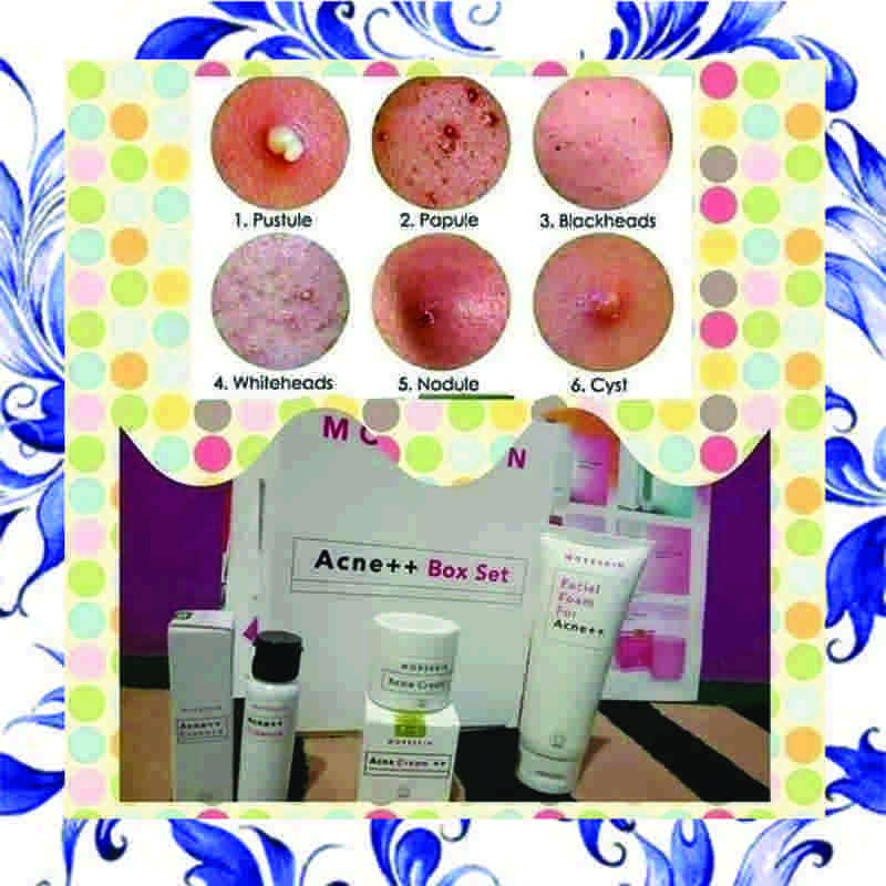 serum acne nasa