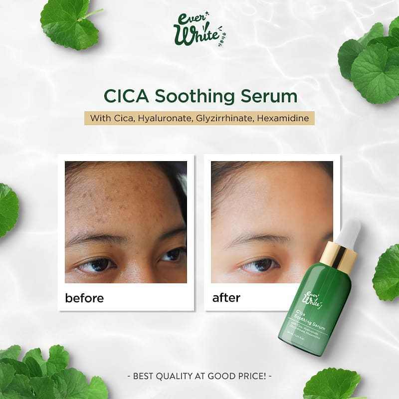 cica everwhite serum