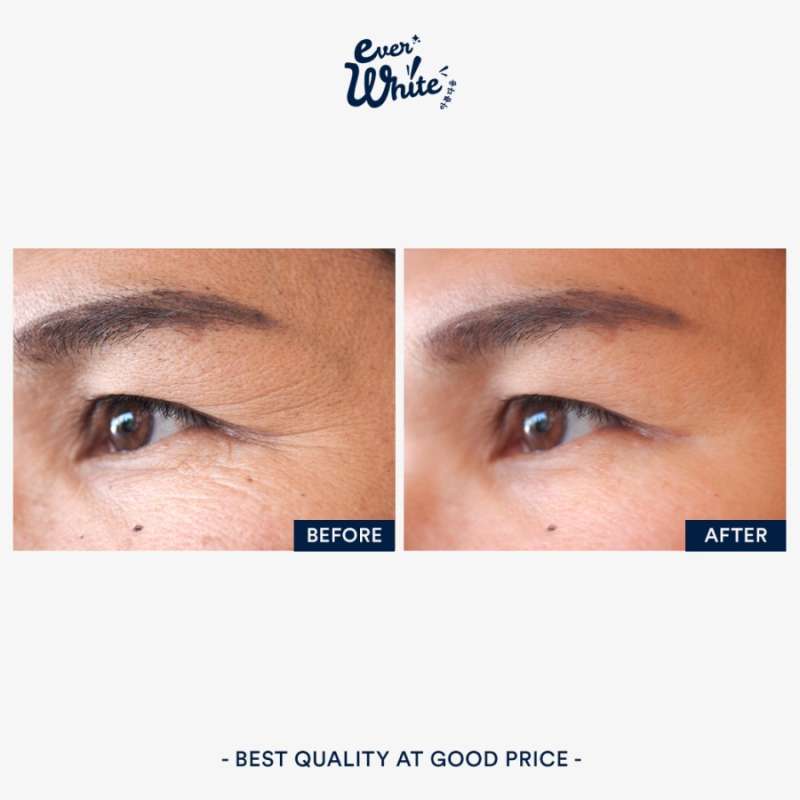 everwhite eye cream