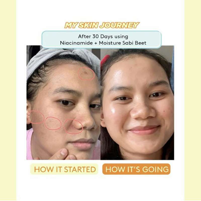 Somethinc 5 Niacinamide Moisture Sabi Beet Serum 40ml Besar Terbaru Agustus 2021 Harga Murah Kualitas Terjamin Blibli