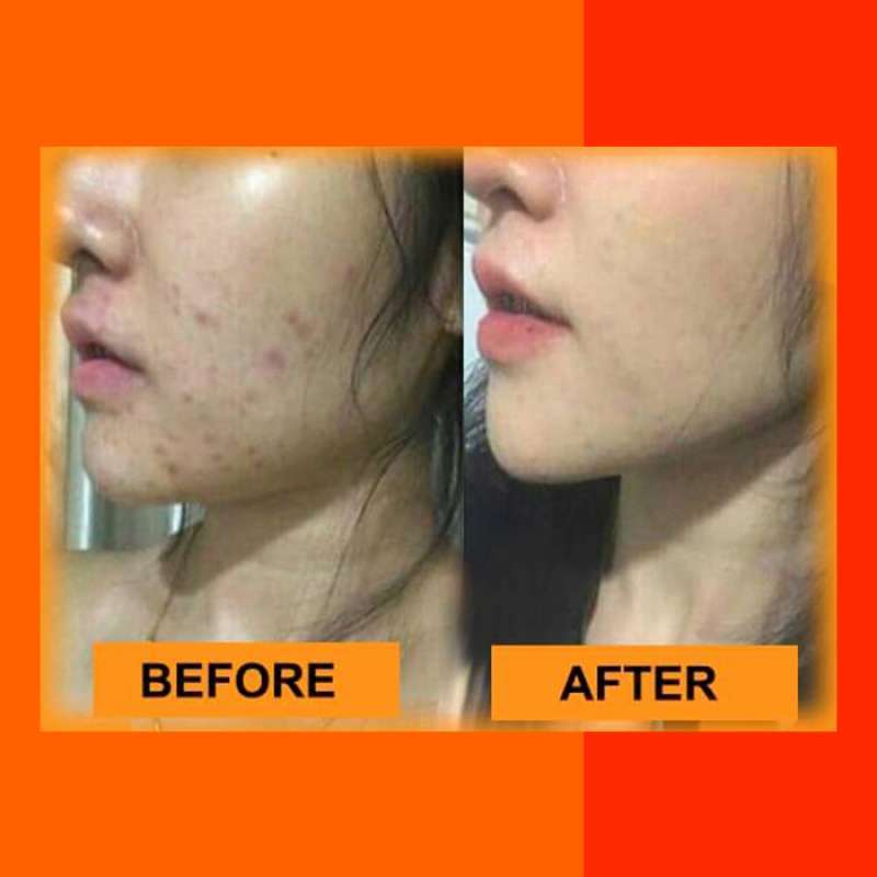Sabun Espio Kolagen 100 Original Aman Bpom Sabun Muka Wanita Pria Untuk Kulit Sensitif Jerawatan Pencerah Putih Alami Beli 2 Dapat 3 Terbaru Juli 2021 Harga Murah Kualitas Terjamin Blibli