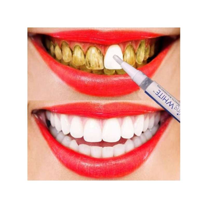Jual Pemutih Gigi Instant Teeth Whitening Gel Pen Dazzling White Murah Online Desember 2020 Blibli
