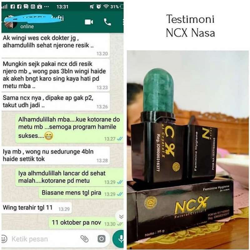 Ncx nasa menurut dokter