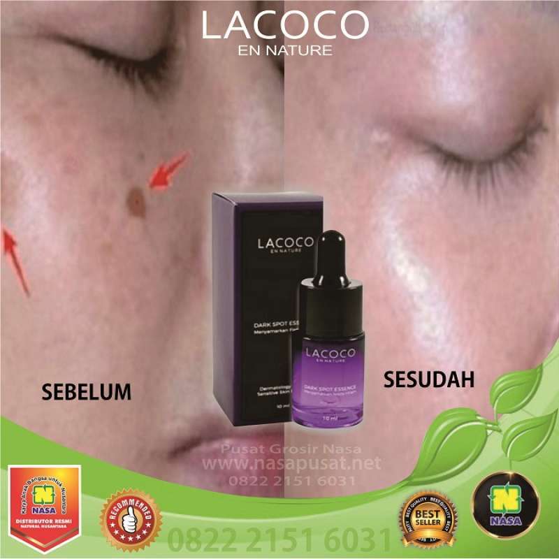 Jual Lacoco Anti Flek Penghilang Bekas Jerawat Paling Ampuh Online Februari 2021 Blibli Untuk menghilangkan bopeng bekas jerawat dengan witch hazel, anda hanya perlu mengoleskan gel bahan alami ini pada kulit wajah. lacoco anti flek penghilang bekas jerawat paling ampuh