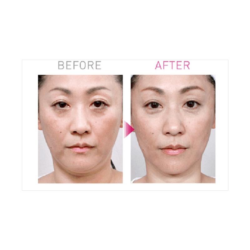 MTG PAO Facial Fitness Peralatan Olahraga - White