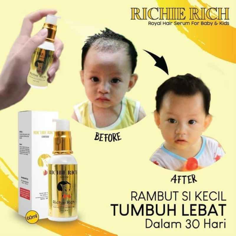 Jual Richie Rich Serum Vitamin Penumbuh Rambut Lebat Di Seller Shennshop Kota Tangerang Selatan Banten Blibli