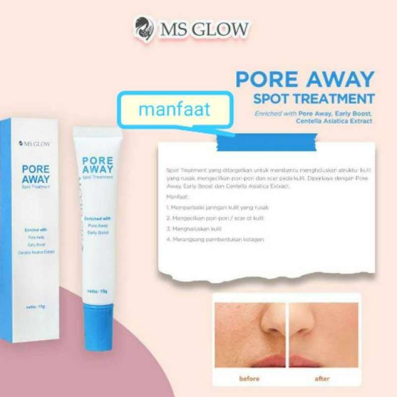 Jual Pore Away Spot Treatment Ms Glow Ms Glow Pore Away Treatment Online Desember 2020 Blibli