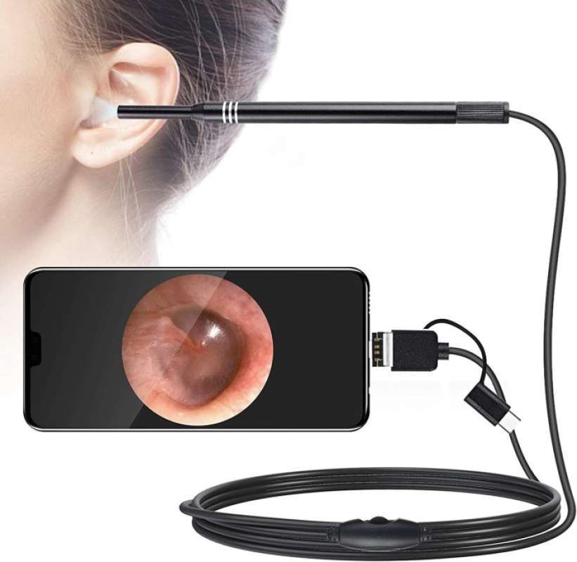 earwax kamera