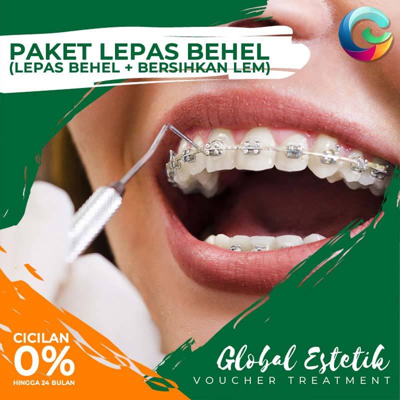 Jual Global Estetik Paket Lepas Behel Classic Ticket Treatment Online Desember 2020 Blibli