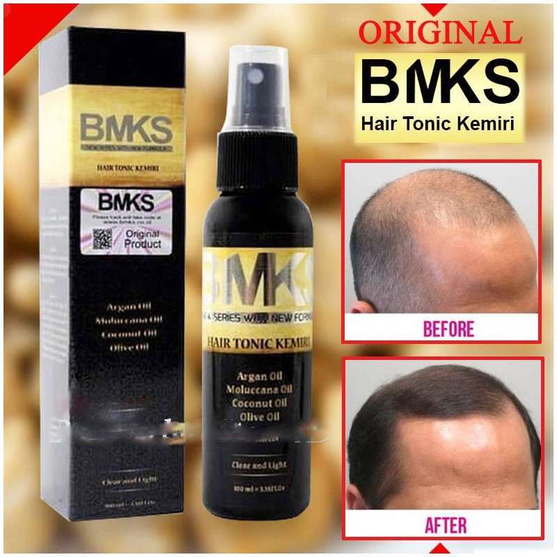Jual Bmks Hair Tonic Original Bpom Minyak Kemiri Penumbuh Penyubur Rambut Serum Perawatan Rambut Rontok Di Seller Dhamira Store Kota Bekasi Jawa Barat Blibli