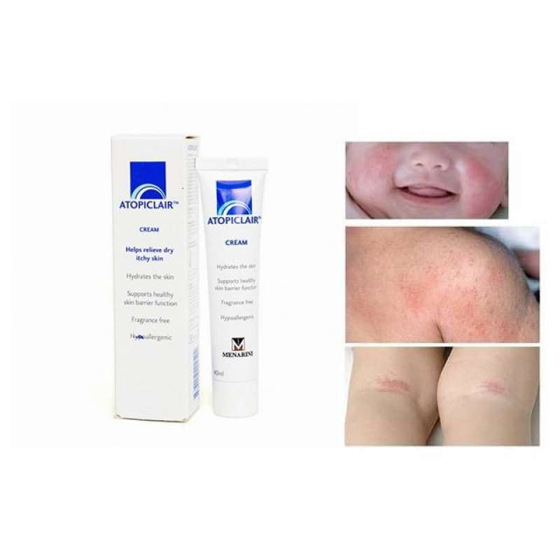 Atopiclair Cream Krim Ruam 40 ml