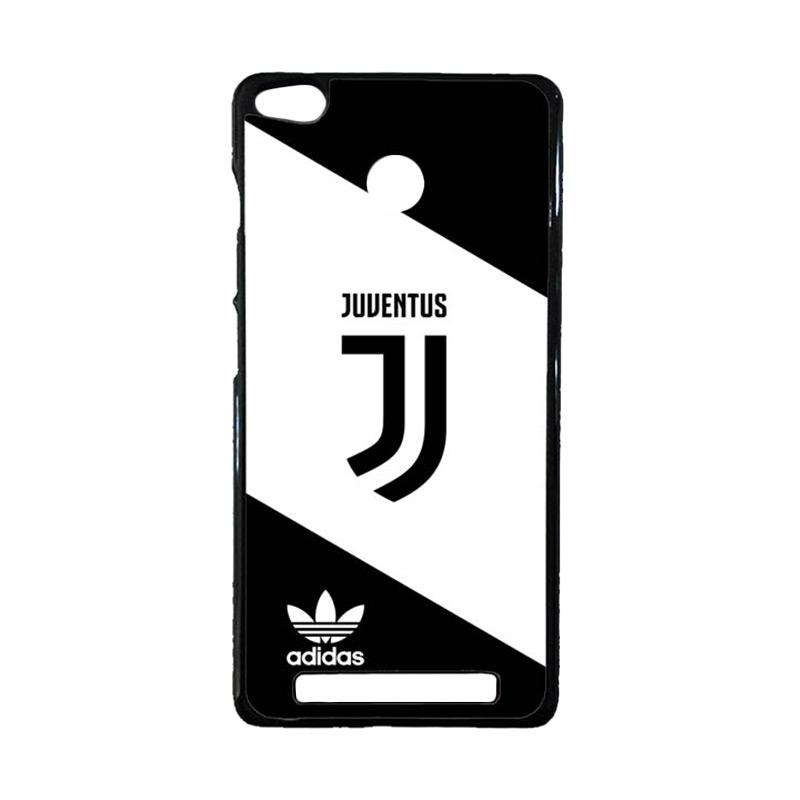 Jual Bunnycase Juventus New Logo Adidas Z4735 Custom Hardcase Casing For Xiaomi Redmi 3 Pro Or 3s Online Oktober 2020 Blibli Com