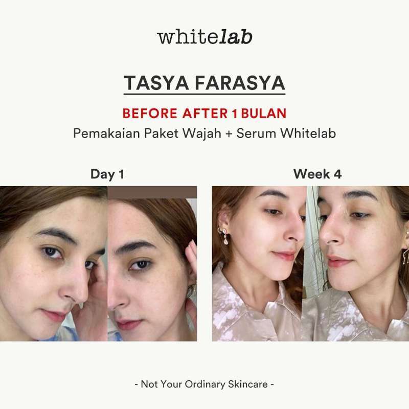 serum acne whitelab