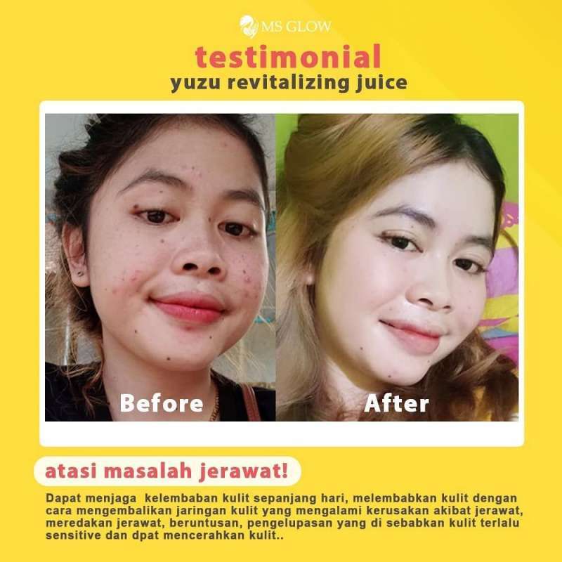 harga yuzu revitalizing juice ms glow