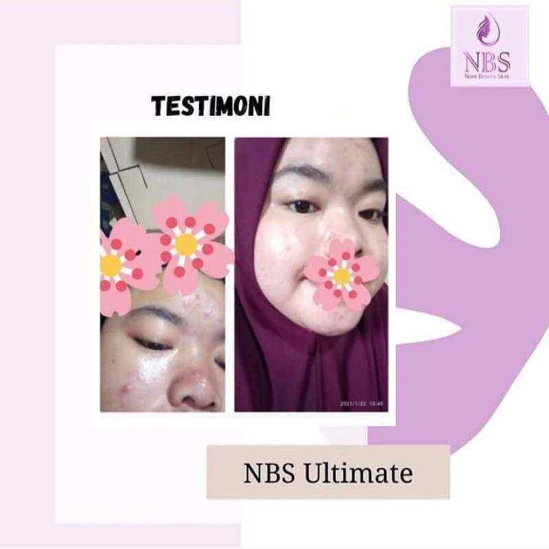 glow glowing skincare testimoni