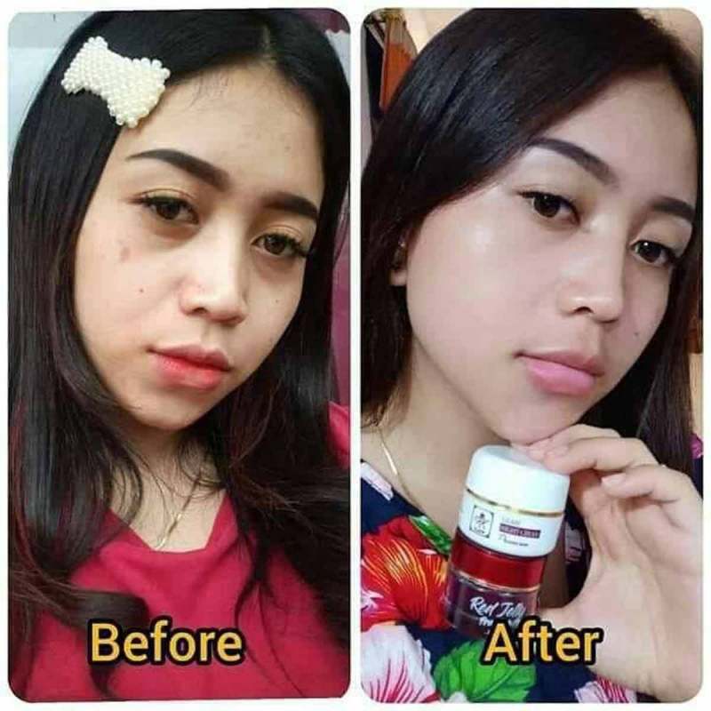 Jual Rk Kosmetik Paket Glow Premuim With Red Jelly Original Murah Mei 2021 Blibli