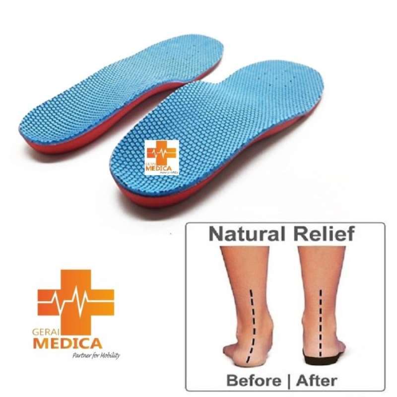 Medial arch outlet support