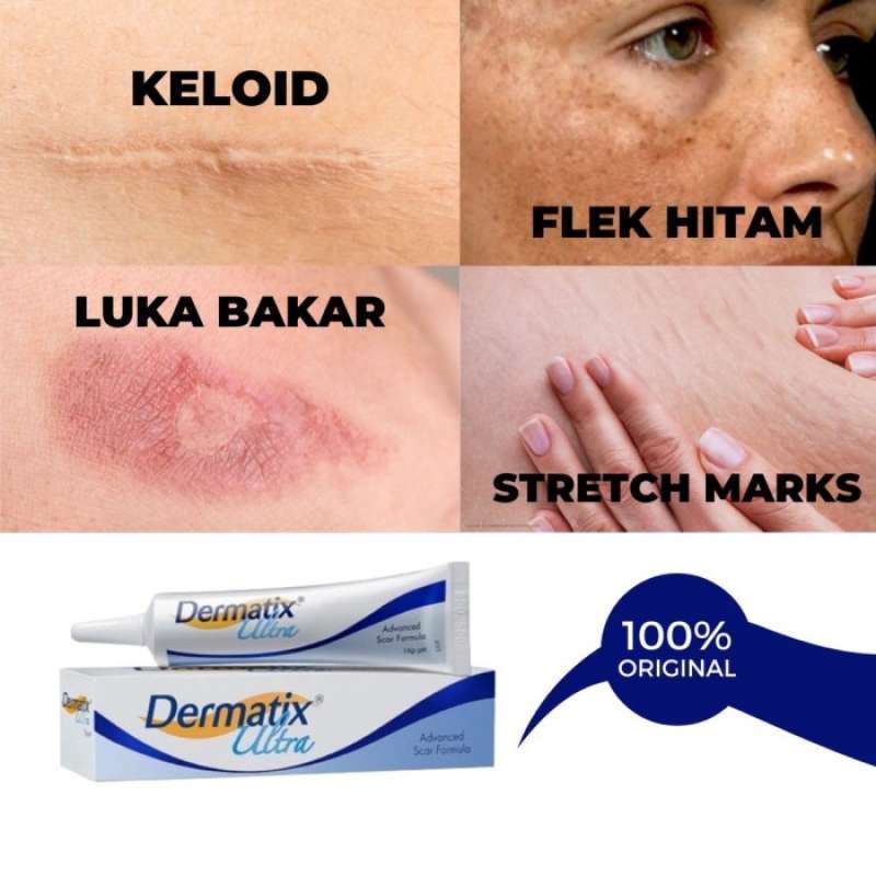 Dermatix hot sale ultra cream