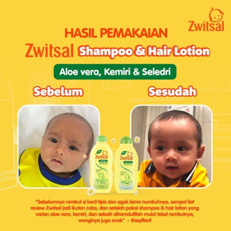 Promo Zwitsal Natural Baby Hair Lotion Aloe Vera Kemiri Seledri