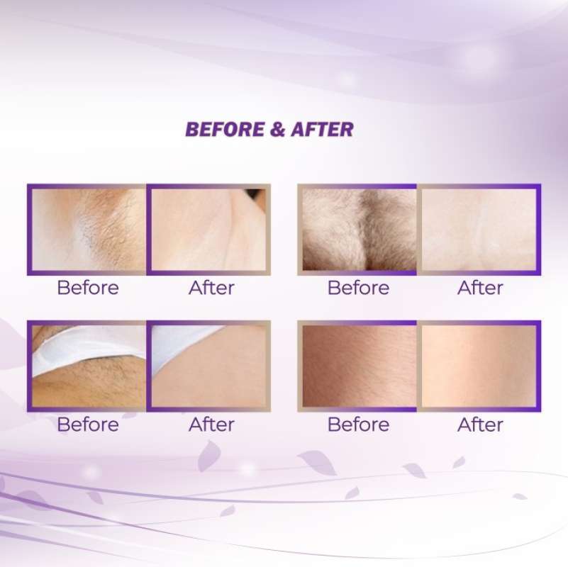 Promo diskon Alat Ipl Lescolton Hair Removal T900i Rejuv Acne Layar Lcd Diskon 23 Di Seller Yunyun Kebon Kacang Kota Jakarta Pusat Blibli