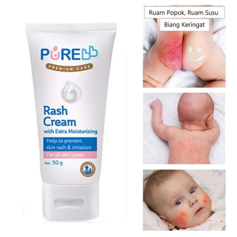 Rash hotsell cream bayi