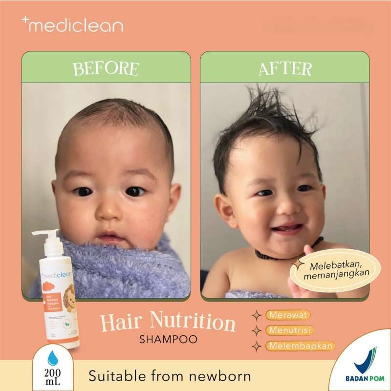 Jual An2323 Mediclean Baby Newborn Hair Nutrition Shampoo Di