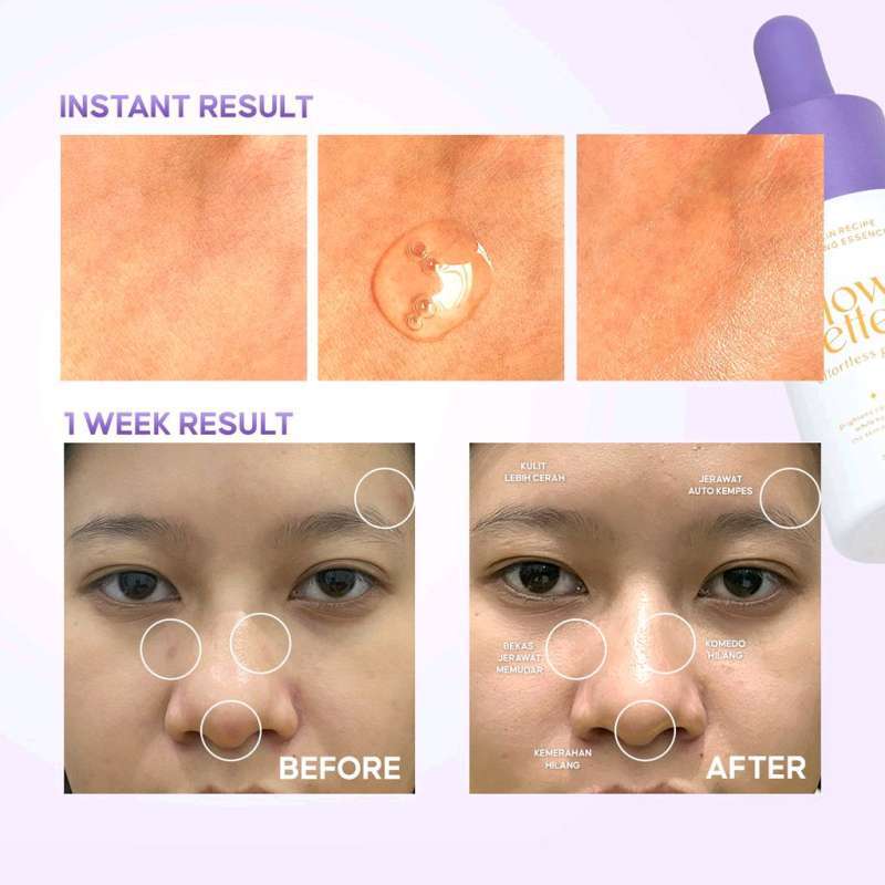 Promo Glow Better Cloud Skin Recipe Brightening Essence 20ml Diskon 46