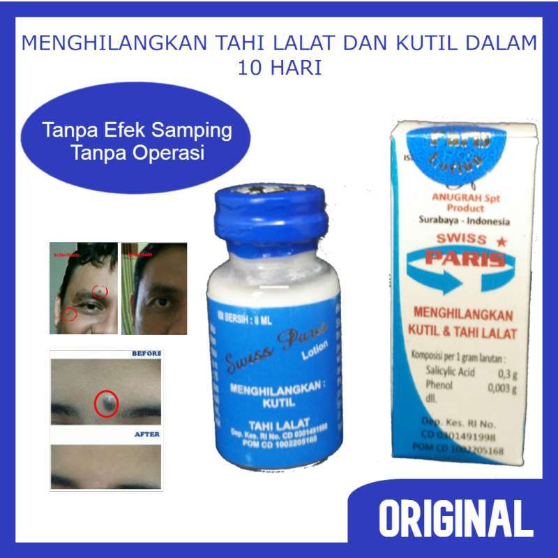 Jual Swiss Paris Lotion Penghilang Tahi lalat dan Kutil di Seller