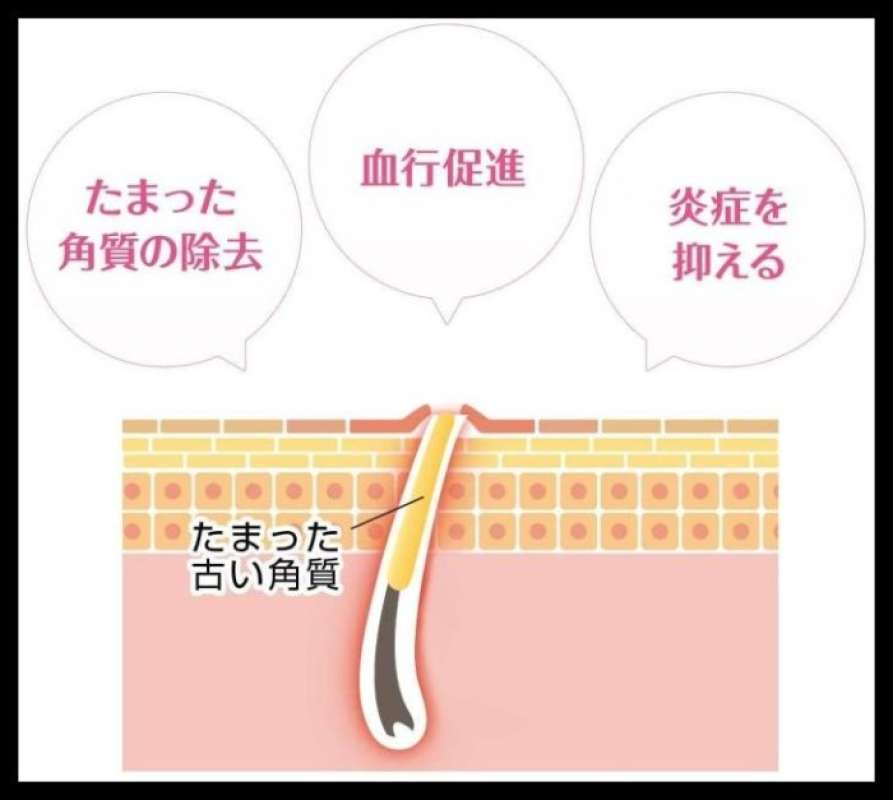 Promo Obat Kobayashi Nino Cure Medicated Cream For Keratosis Pilaris