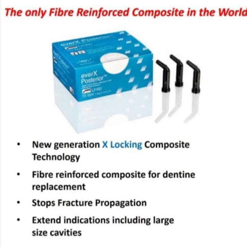 thumbnail image 2 of GC EverX Posterior - Fibre-Reinforced Composite For Dental Build-Ups 2 of 5