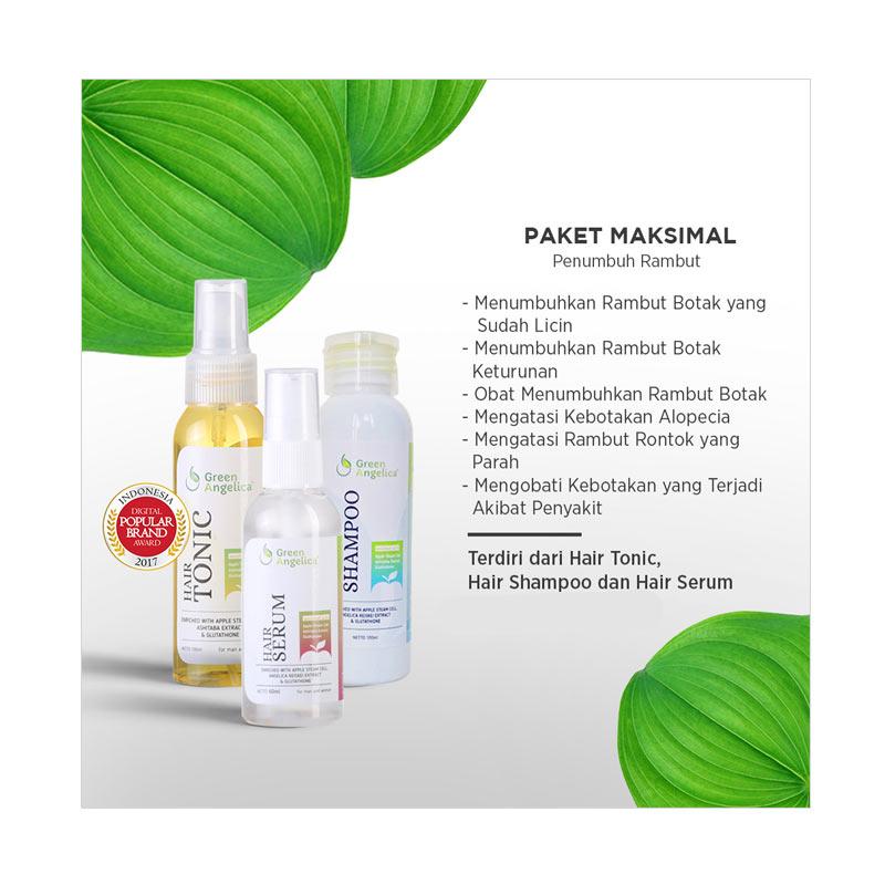 Treatment Rambut Rontok : Hijab Beauty: Rambut Rontok Karena Hijab