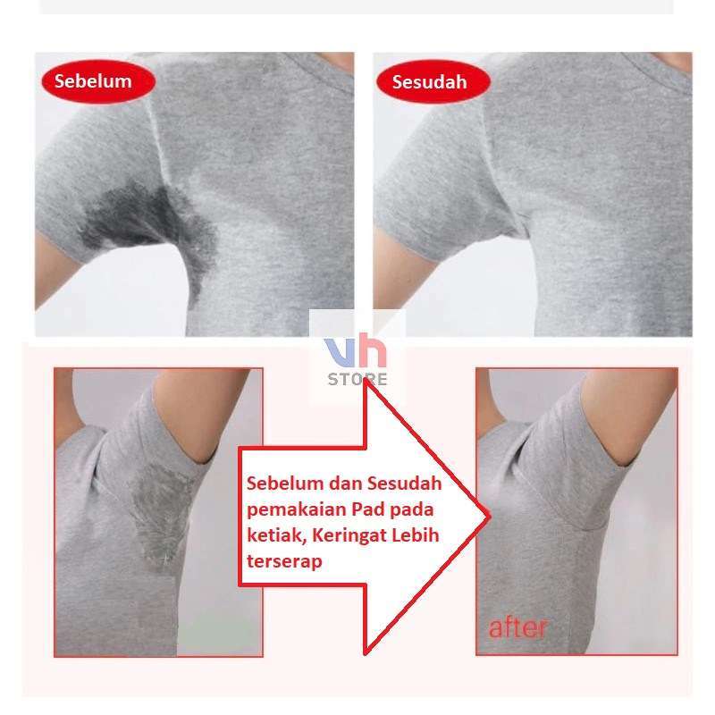 Jual Alas Ketiak Ketek Dress Shields Underarm Pad Panty Liners Bantalan