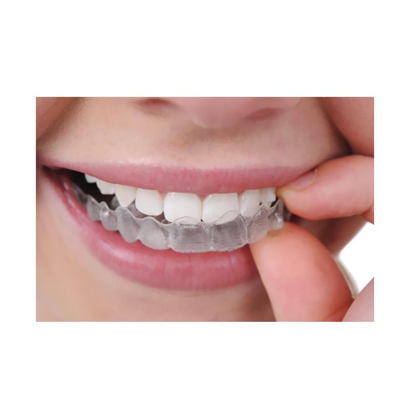 Jual Bogor Dental Center - Invisalign 3 Voucher Murah ...