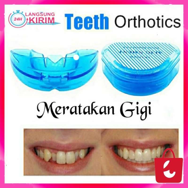 Jual Alat Perapi Gigi Karet Biru Perata Gigi Pelurus Gigi Teeth Trainer ...