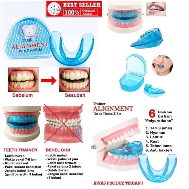 Jual Alat Perapi Gigi Karet Biru Perata Gigi Pelurus Gigi Teeth Trainer ...