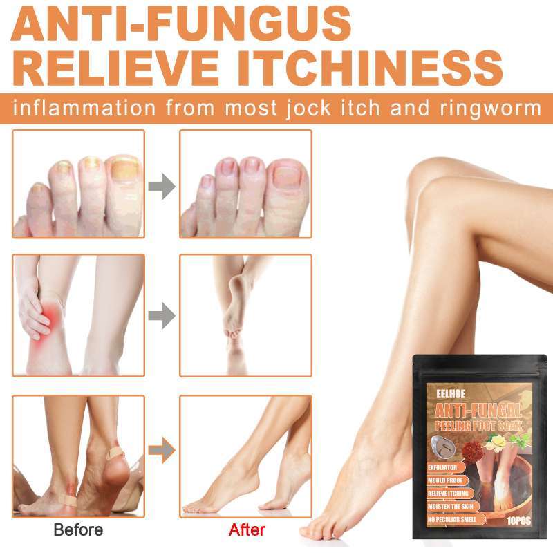 Jual AntiFungal Peeling Foot Soak to Remove Toenail Fungus, Foot Odor