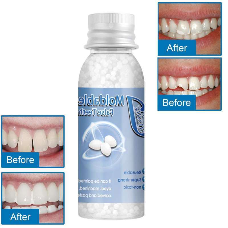 Promo Temporary Tooth Repair Kit Denture Adhesive Teeth Gaps for Broken